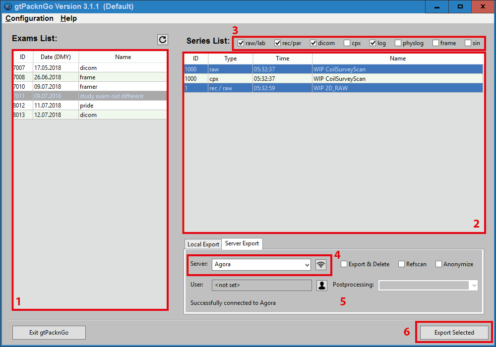 ../../../_images/philips_gtpackngo_UI_labels.png