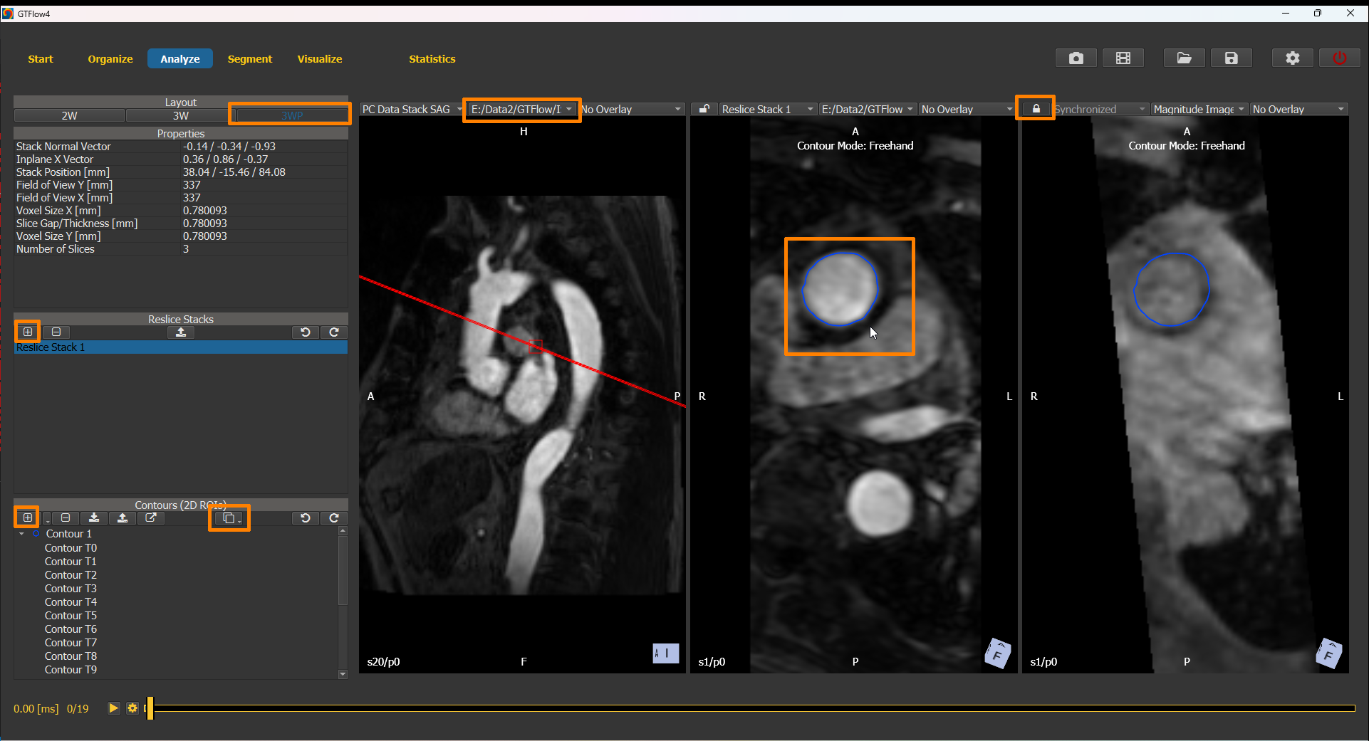 ../../_images/segmentation_withangio2.png